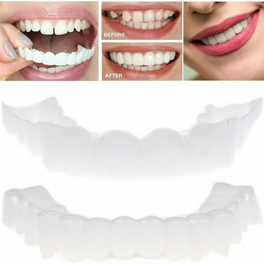 Snap-On Smile | Temporary Cosmetic Teeth Cover for a Brighter Smile