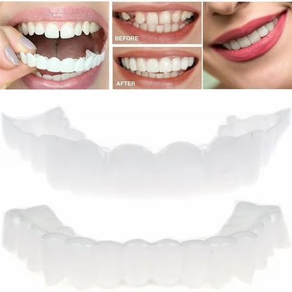 Snap-On Smile | Temporary Cosmetic Teeth Cover for a Brighter Smile